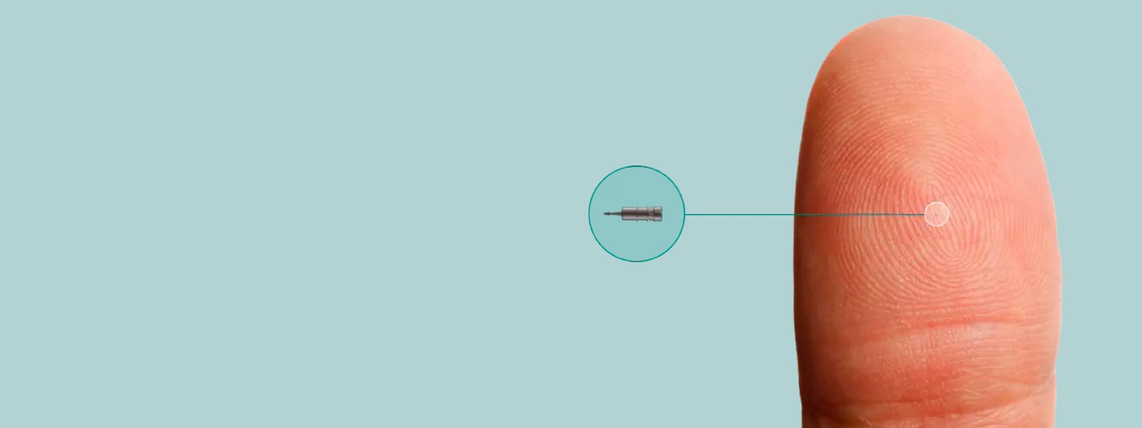 iDose banner diagram of what the implant looks like on a finger. It's so small.