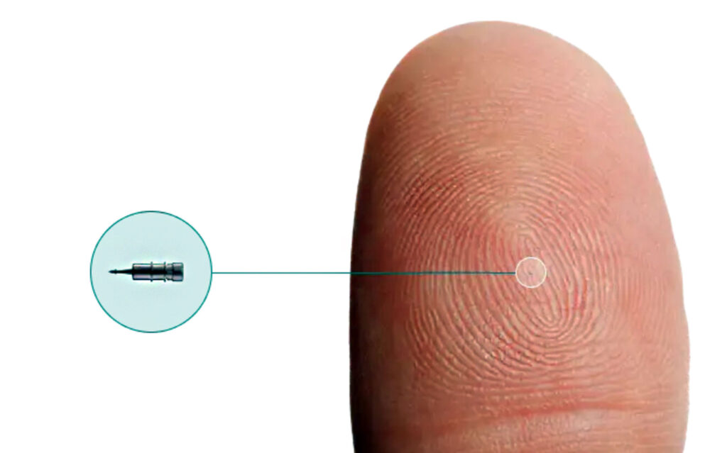 iDose Tr implant shown actual size on a fingertip, is a treatment option if you-have-glaucoma-with-normal-eye-pressure-oct-southwest-eye-institute