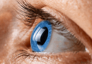 Keratoconus of the eye, close up can force vision prescription changes at Southwest Eye Institute.